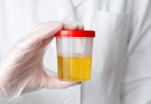 Cómo detectar y tratar infecciones de orina en ancianos